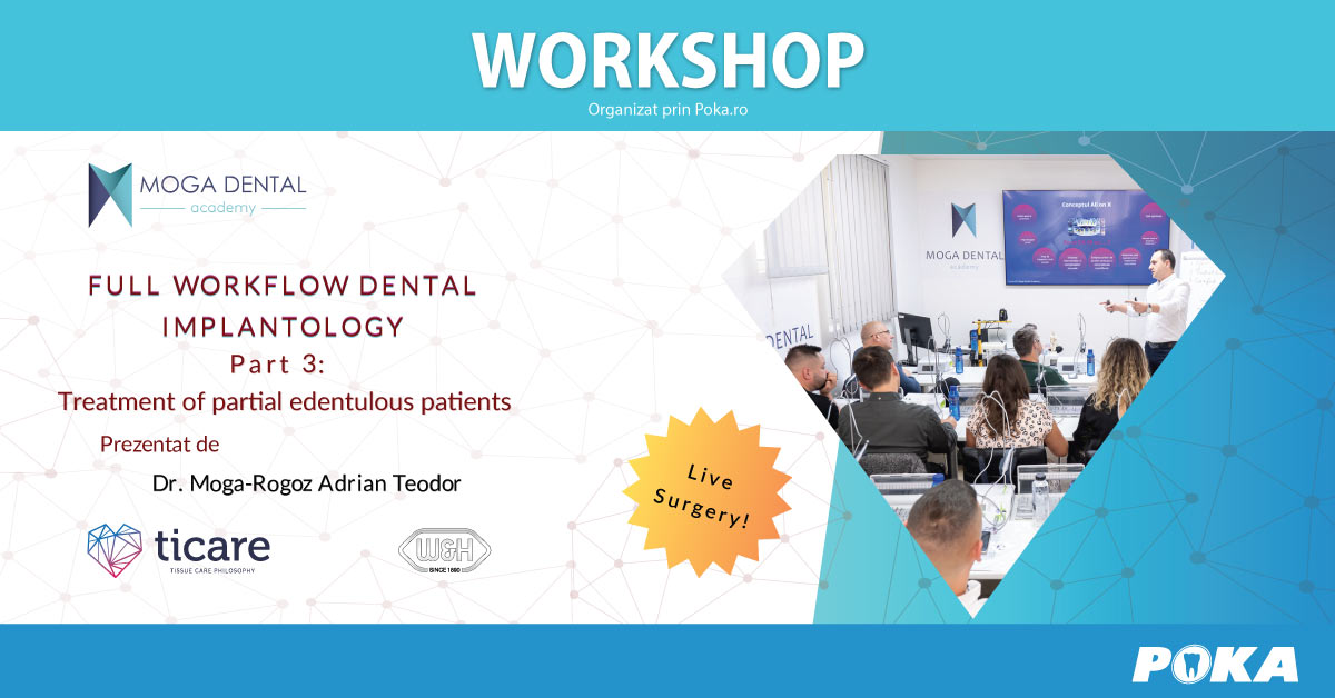Full workflow in dental implantology - Part 3 Treatment of partial edentulous patients