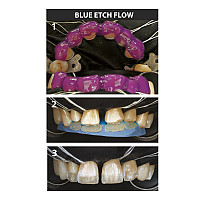 Blue Etch Gel Demineralizant Mov 10ml CERKAMED - imagine 2