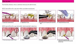 GC G-aenial Bond Botle 5 ml - imagine 2