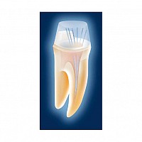 Voco Rebilda Post GT 1.4mm fascicul pivoti fibra de sticla