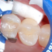 Inel Fixare Matrice FX400-1 Garrison