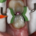 Inel Fixare Matrice set FX600-1 Garrison