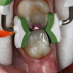 GR Inel Composi-Tight 3D Fusion wide prep verde #FX600-1