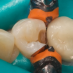 Inel Fixare Matrice 3D500-1 Garrison