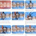 Metafix assort kit 3604