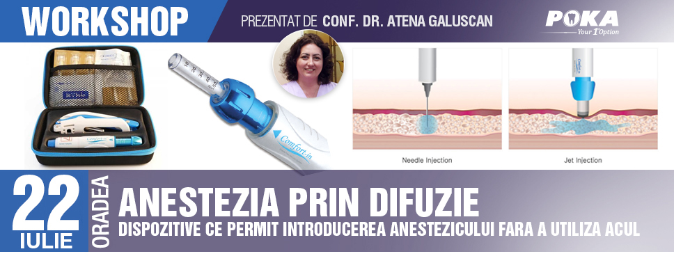 Evolutia anesteziei Anestezia prin difuzie Anestezia fara ac, fara durere!