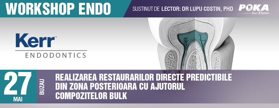 Realizarea restaurarilor directe predictibile din zona posterioara cu ajutorul compozitelor Bulk