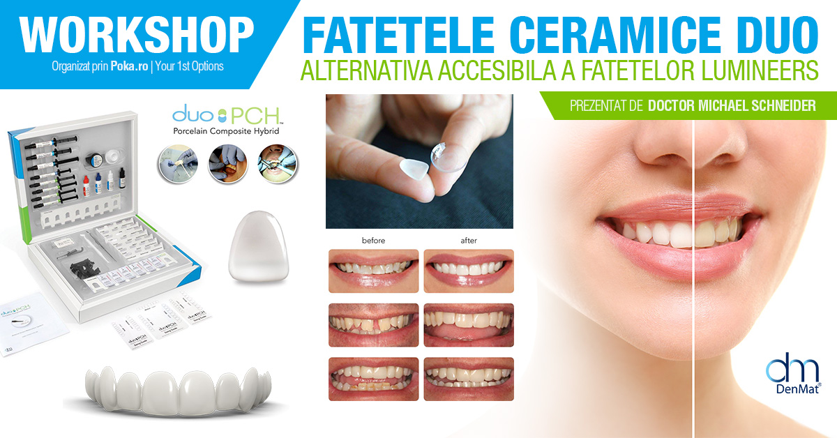 Fatetele ceramice prefabricate DUO- alternativa accesibila a fatetelor LUMINEERS