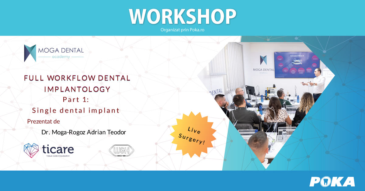 Full workflow in dental implantology - Part 1 Single dental implant