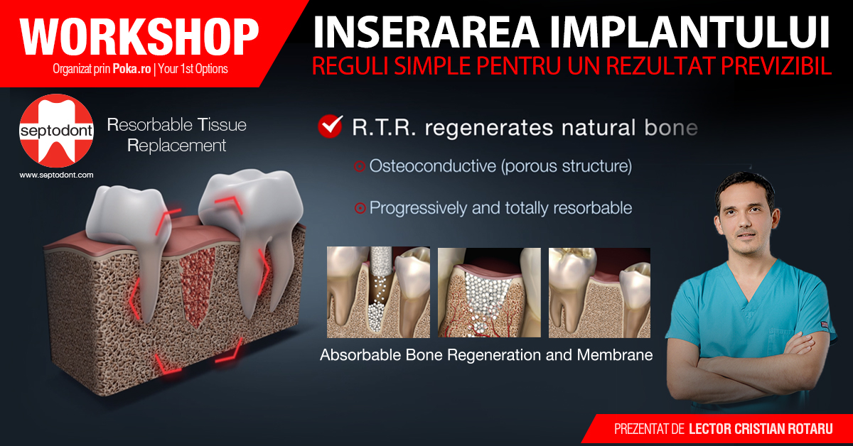 Inserarea implantului - reguli simple pentru un rezultat previzibil