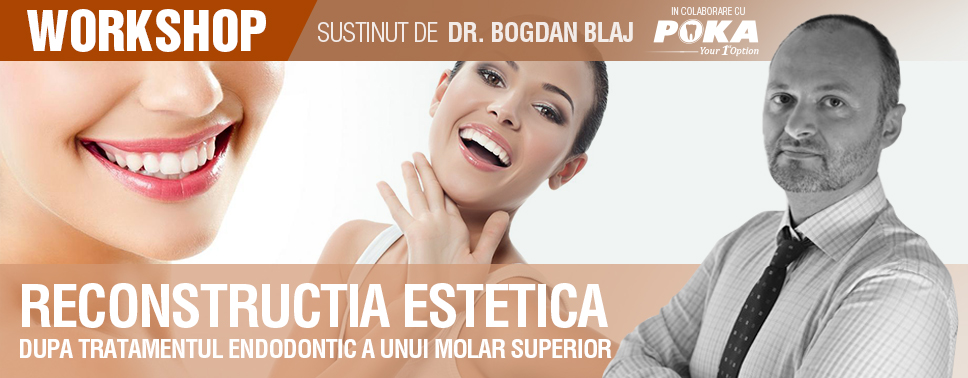 Reconstructia Estetica dupa tratamentul endodontic a unui molar superior